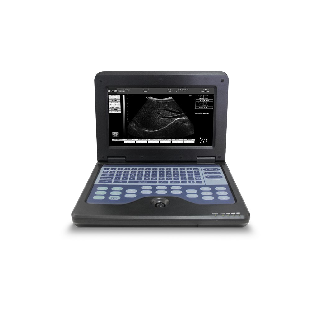 CMS600P2-VET 3d Laptop Vet Portable Medical Ultrasound Instruments Veterinary Scanner Machine B-Ultrasound Diagnostic System