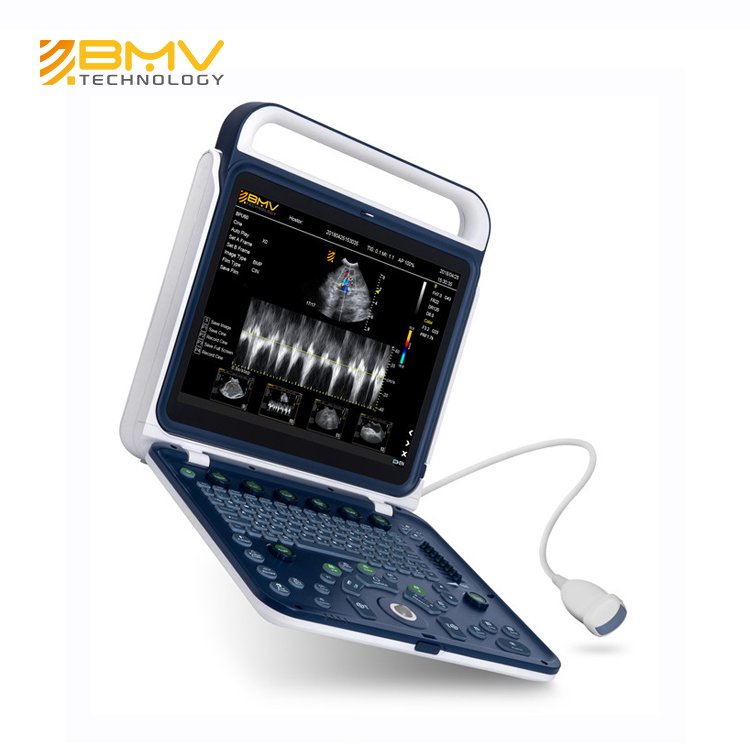 Medical Diagnostic Portable Color Doppler Ultrasound System GYN Ultrasound Machine Price Trolley Medical Ultrasound Instruments