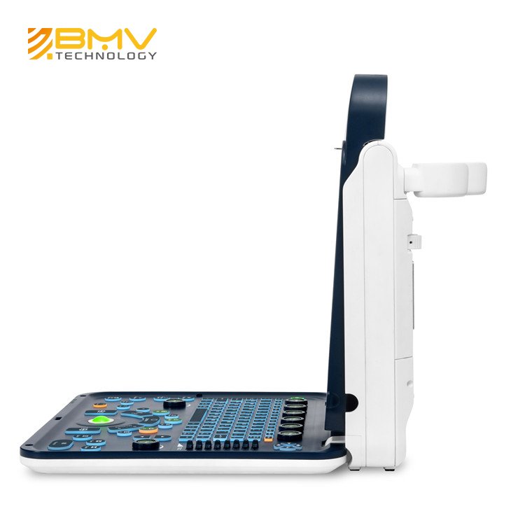 Medical Diagnostic Portable Color Doppler Ultrasound System GYN Ultrasound Machine Price Trolley Medical Ultrasound Instruments