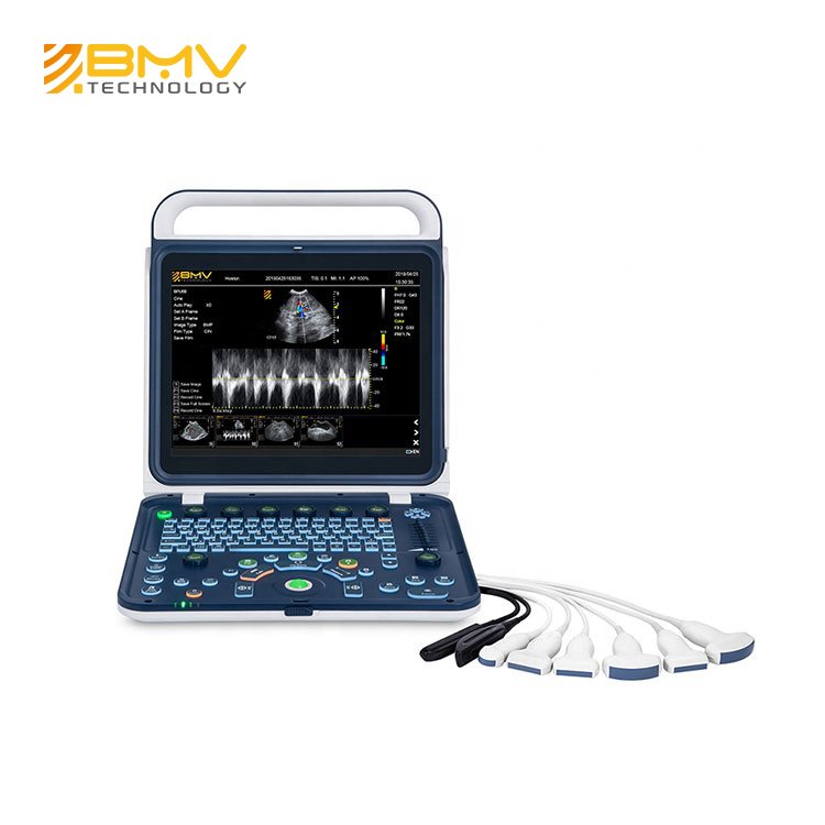 Medical Diagnostic Portable Color Doppler Ultrasound System GYN Ultrasound Machine Price Trolley Medical Ultrasound Instruments