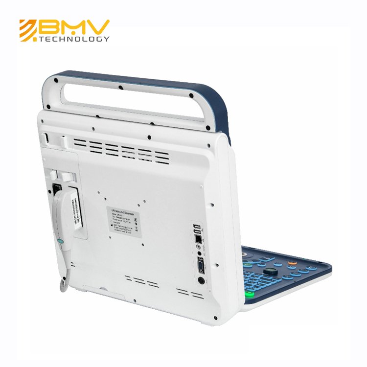 Medical Diagnostic Portable Color Doppler Ultrasound System GYN Ultrasound Machine Price Trolley Medical Ultrasound Instruments