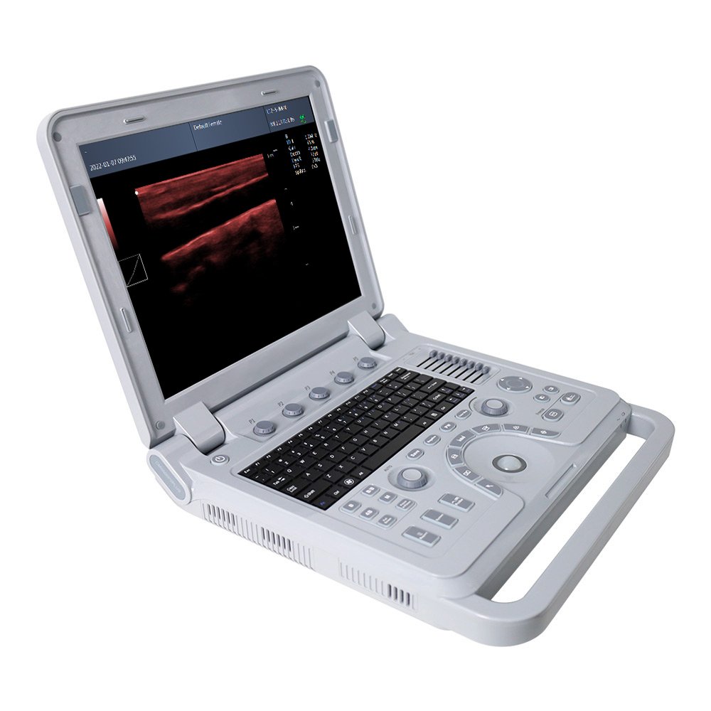 CONTEC CMS600P2PLUS medical ultrasound instruments doppler ultrasound price