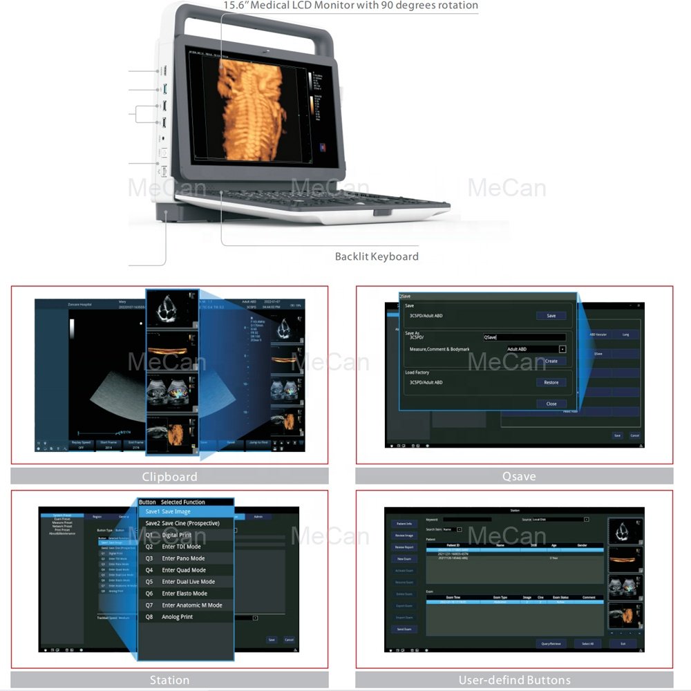 Veterinary Ultrasound Doppler Tablet Ecografos Ultrasonido Scanner 4D Portable Eco Ultrasound Machine for Vet