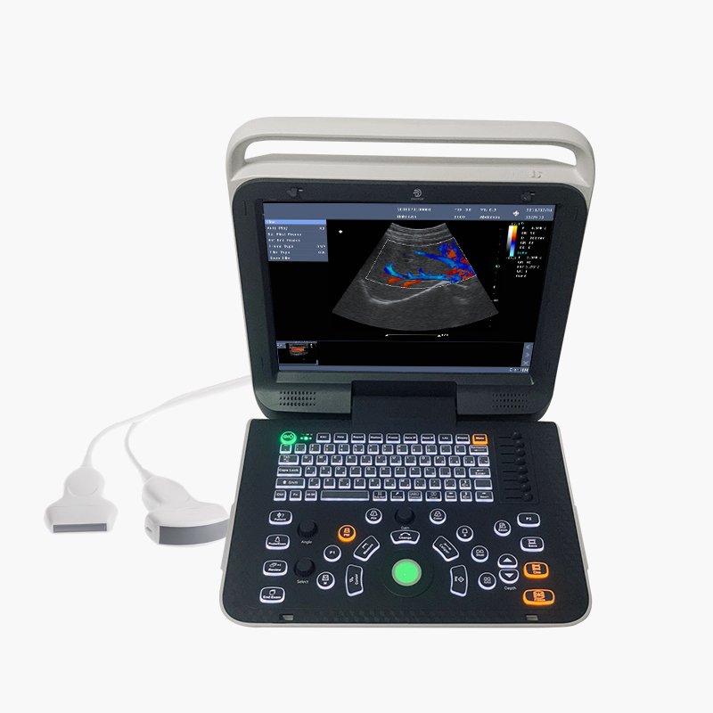 CE Certificate manufacture good price medical Ultrasound Machine babay ctg Fetal Monitor