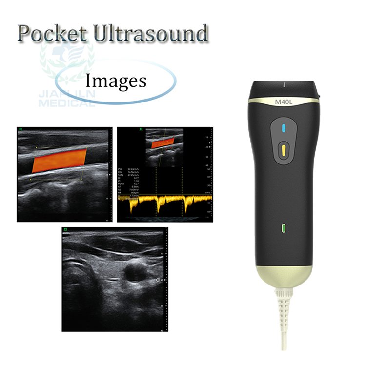 Ultrasound handheld device double-head portable ultrasound WiFi wireless medical ultrasound instrument pocket size