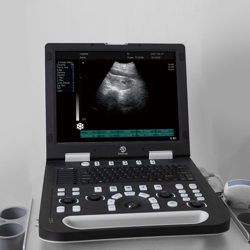 Portable Vet Diagnostic Medical USG Ultrasound scanner pet bovine equine cow cat dog veterinary ultrasound machine