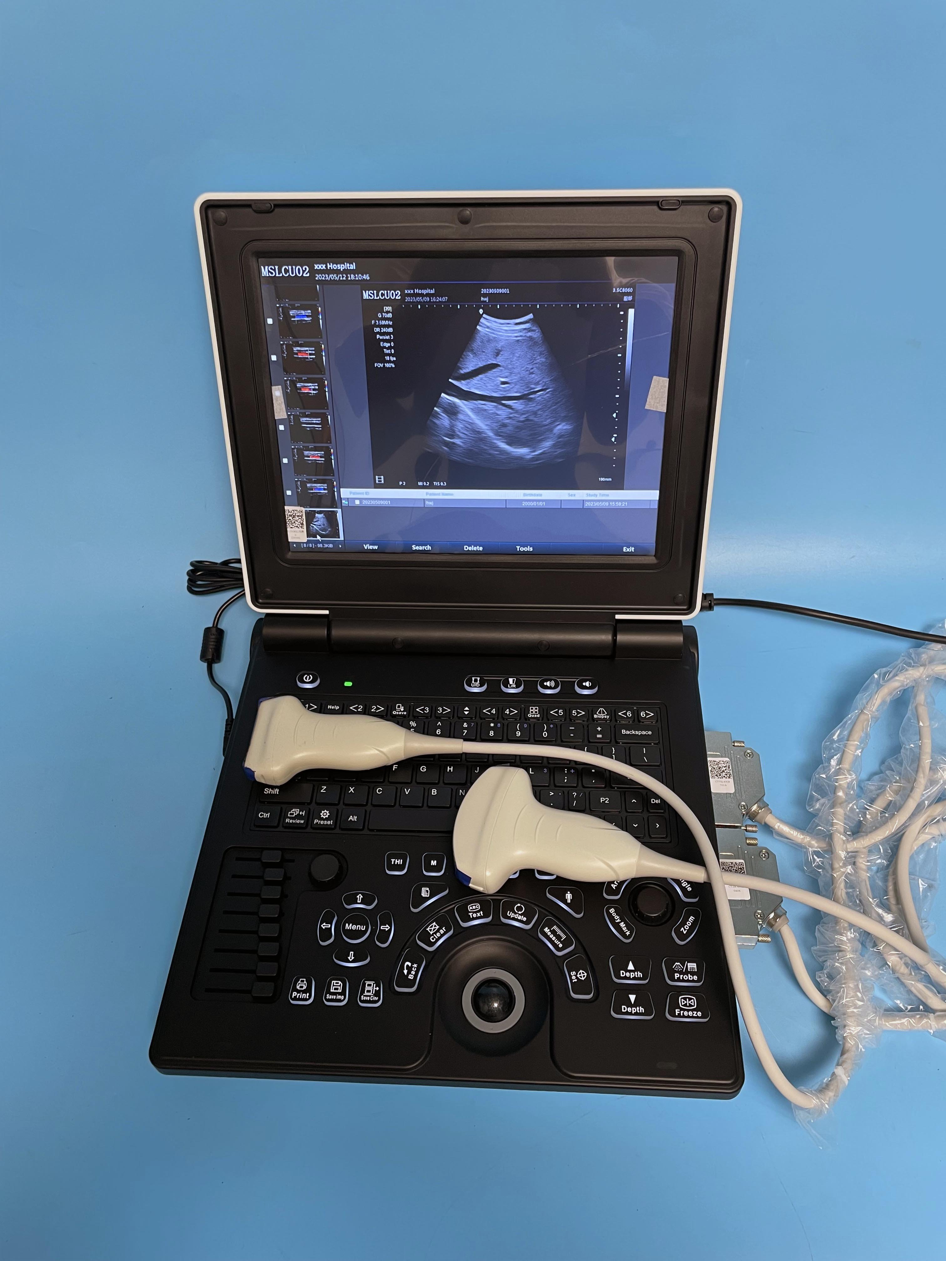 Medical Ultrasound Instruments Hospital Color Doppler Portatil Ecografo Portable Ultrasound Machine