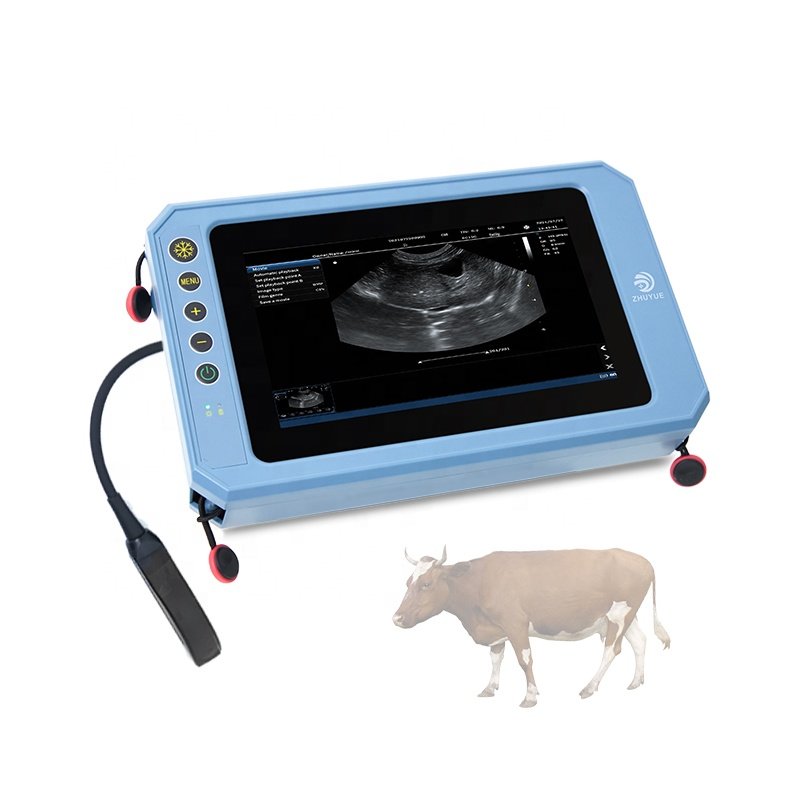 medical echographie portatifs en 3d prix machine ultrasound scanner