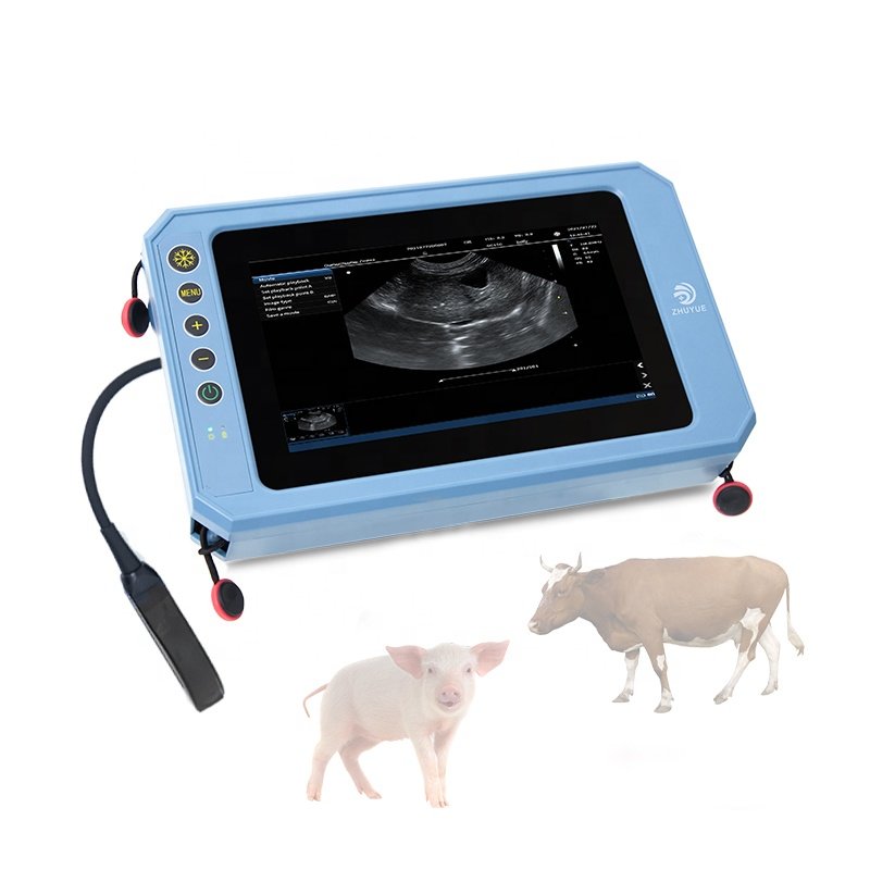 medical echographie portatifs en 3d prix machine ultrasound scanner