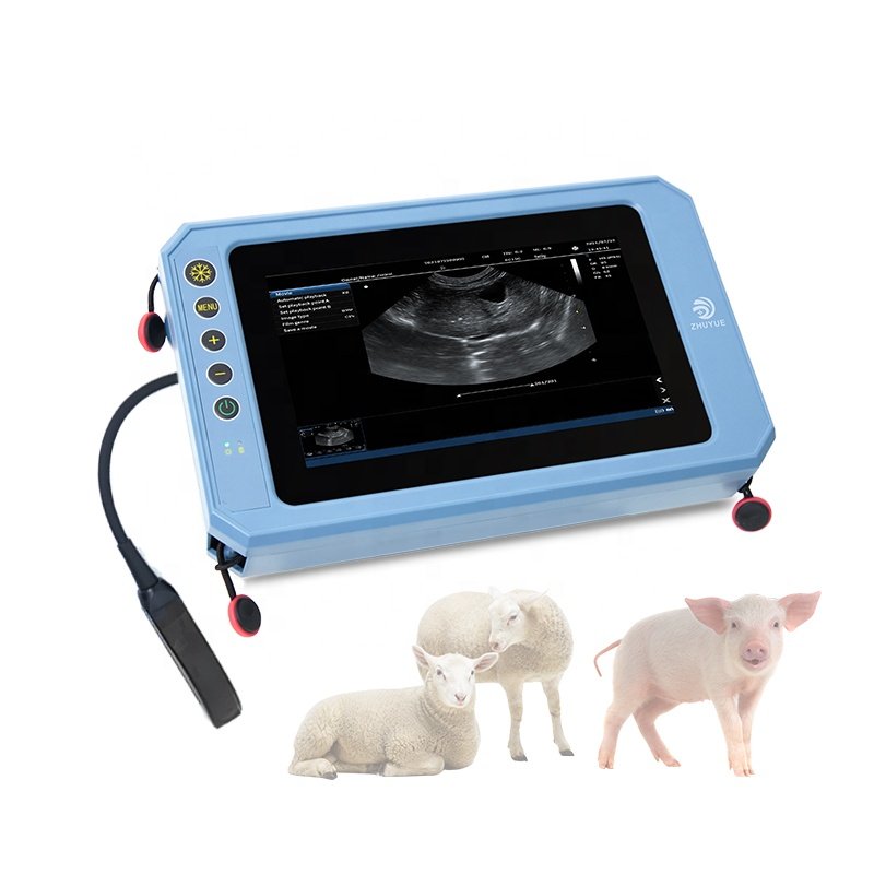 medical echographie portatifs en 3d prix machine ultrasound scanner