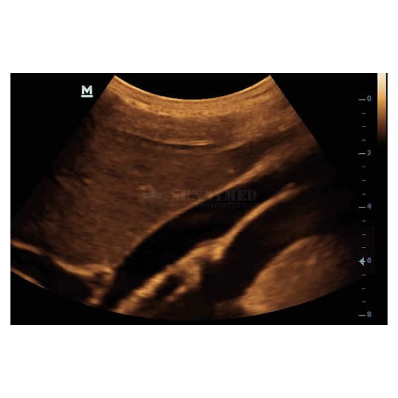 medical portable ultrasound scanner Mindray ultrasound machine mindray dp 10 ultrasound