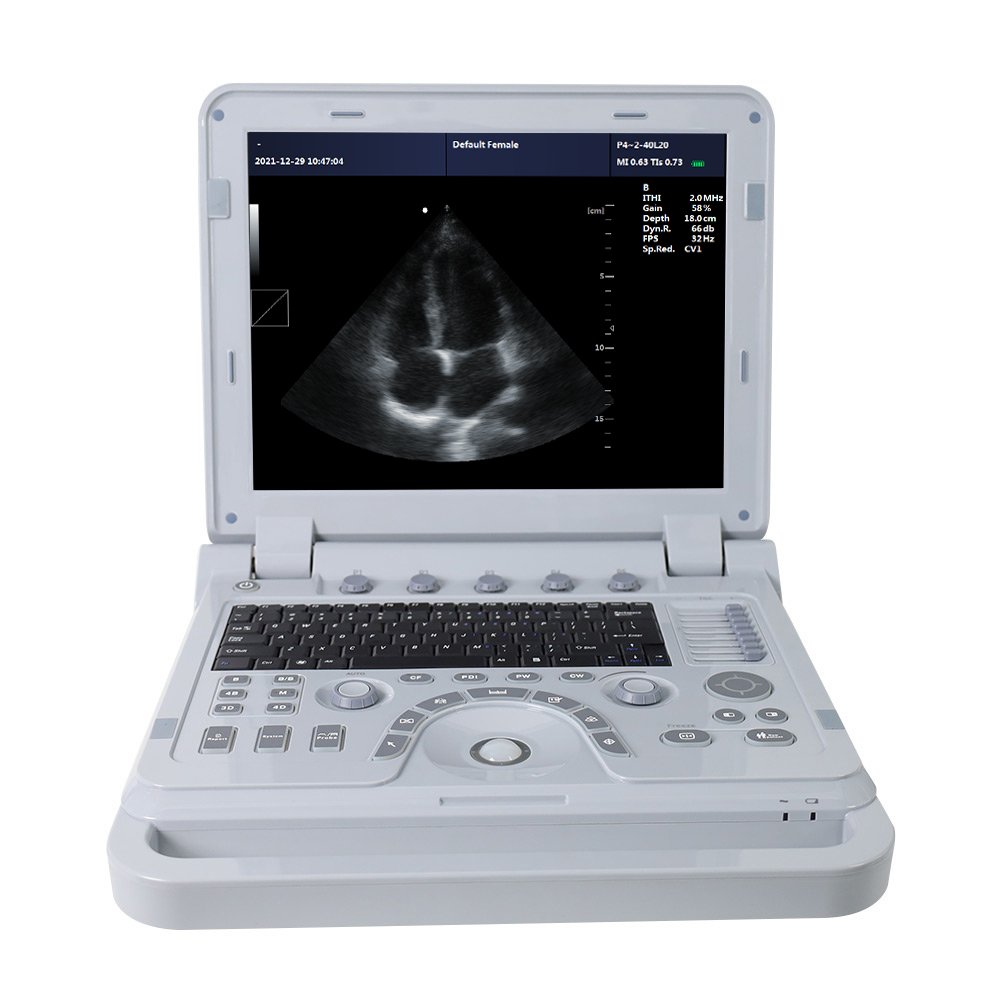 CONTEC CMS1700b doppler medical Echocardiography ultrasound machine