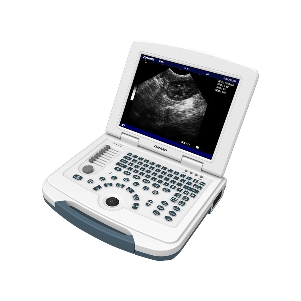 Dawei Dog Puppy Ultrasound Veterinary Ultrasound Machine Medical Ultrasound Instruments