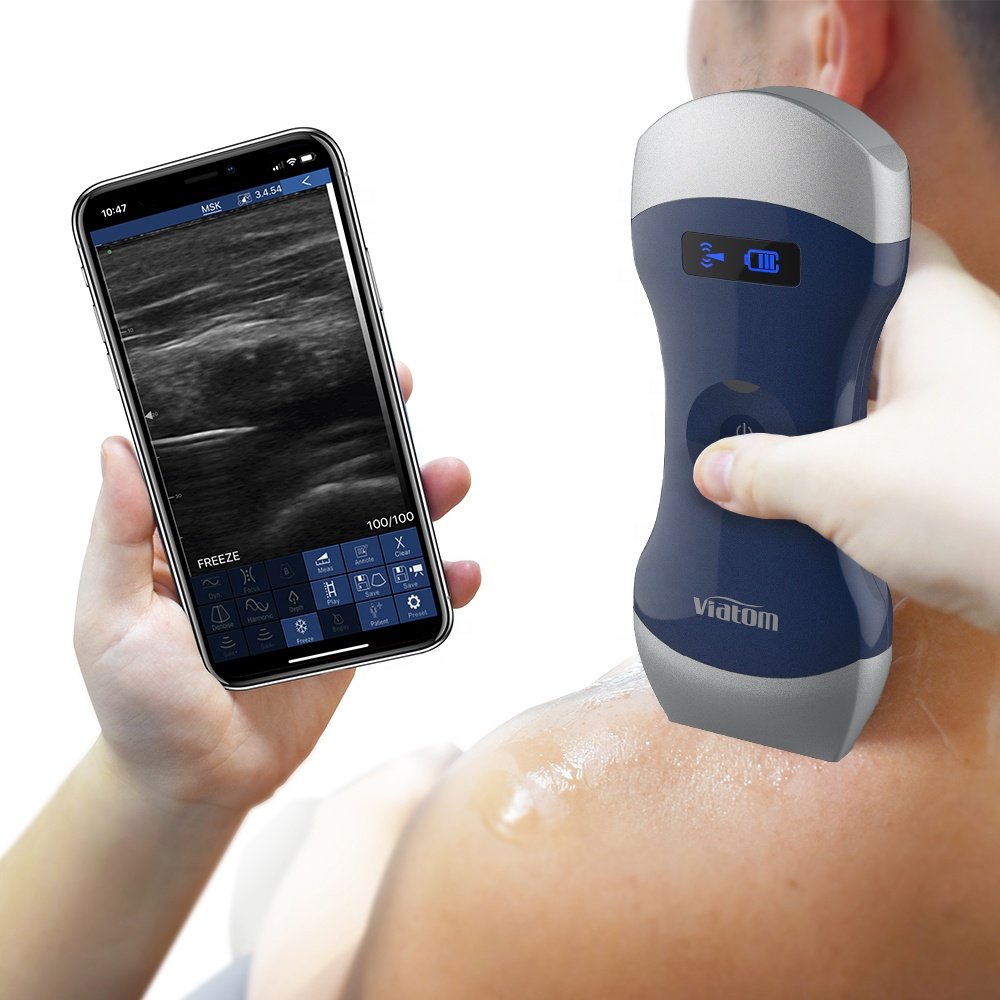 Viatom Wireless Handheld Ultrasound Scanner Weight 260g/0.6 lbs Compatible With Tablets And ios/android Portable Ultrasound