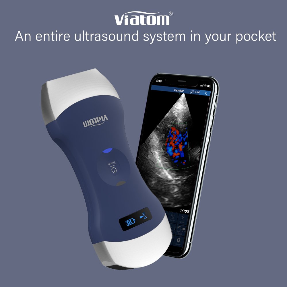 Viatom Wireless Handheld Ultrasound Scanner Weight 260g/0.6 lbs Compatible With Tablets And ios/android Portable Ultrasound