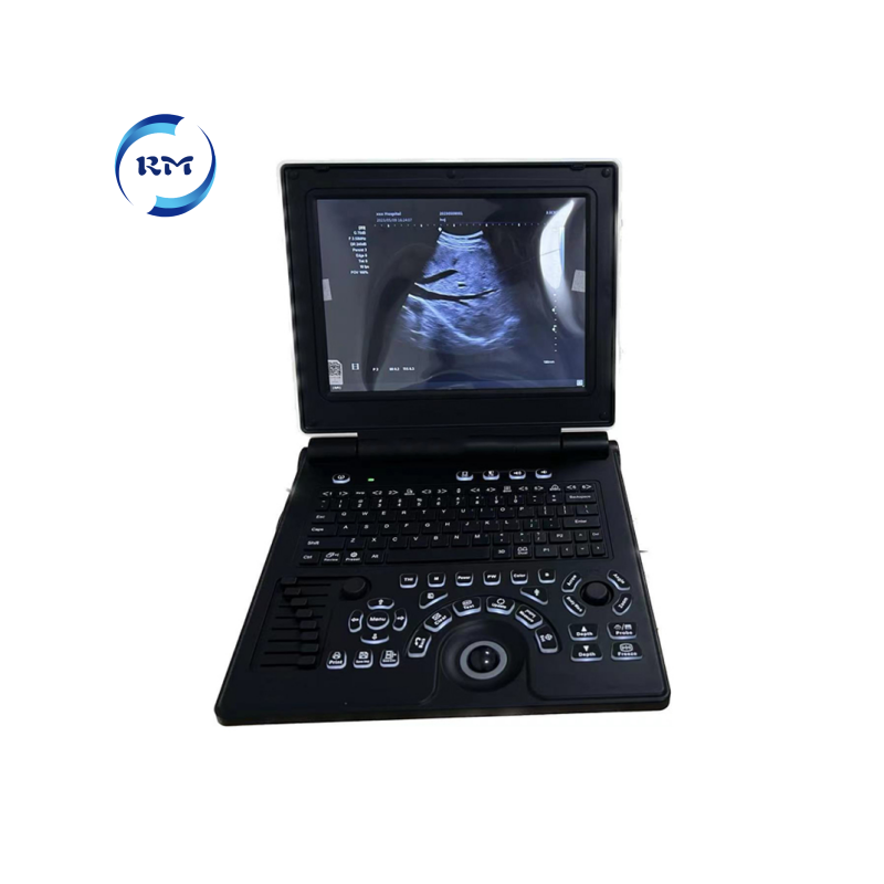 Rayman Veterinary Equipment Vet Full Digital Portable Ultrasound Scanner Machine for Animal