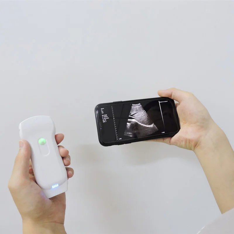 Wireless Potable Ultrasound Scanner with WiFi and USB Connection Color Doppler Handheld Ultrasound Probe for Phone and Tablet