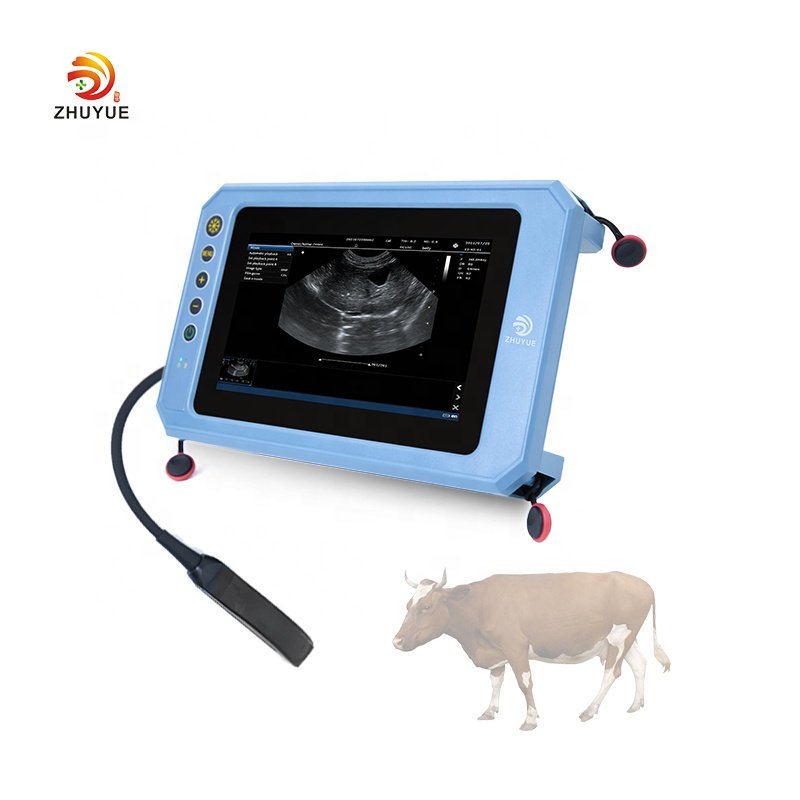 Ready to ship portable medical 3d 4d echocardiography ultrasound machine ecografo color doppler for human