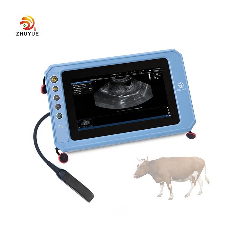 Ready to ship portable medical 3d 4d echocardiography ultrasound machine ecografo color doppler for human