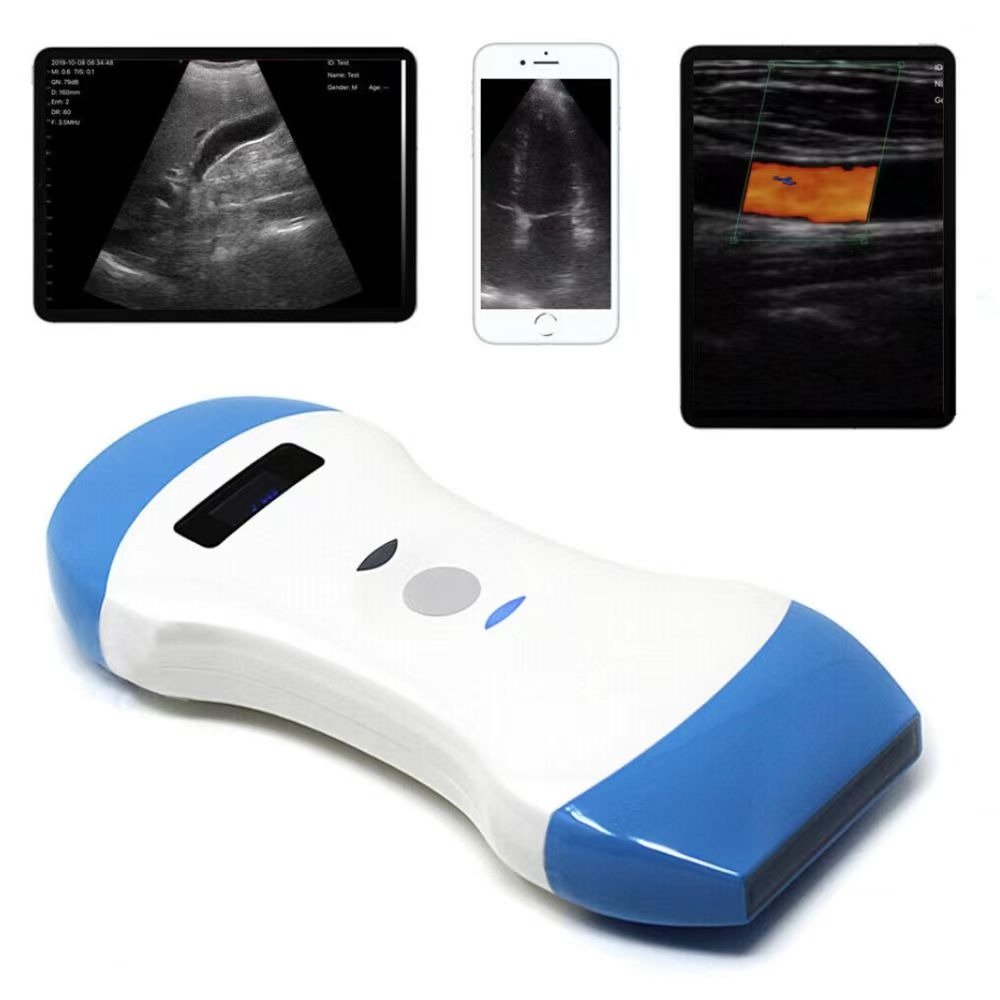 Smart F Vet Veterinary Equipment Portable Wireless Mini Color Doppler Ultrasound Mini Veterinary Ultrasound