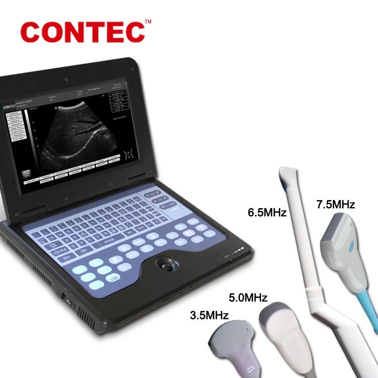 CONTEC CMS600P2 hospital Portable ultrasonic devices Ultrasound Machine medical ultrasound instruments