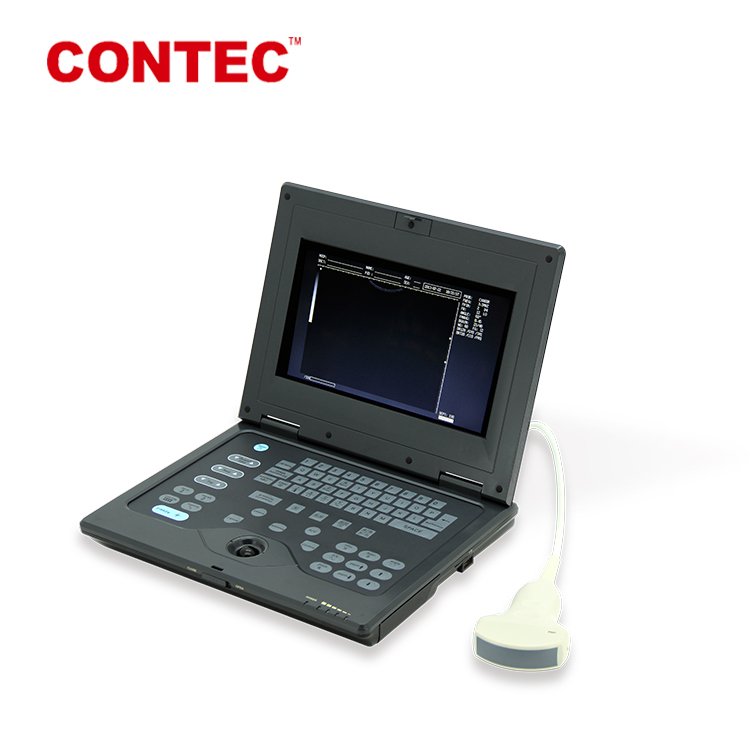 CONTEC CMS600P2 hospital Portable ultrasonic devices Ultrasound Machine medical ultrasound instruments
