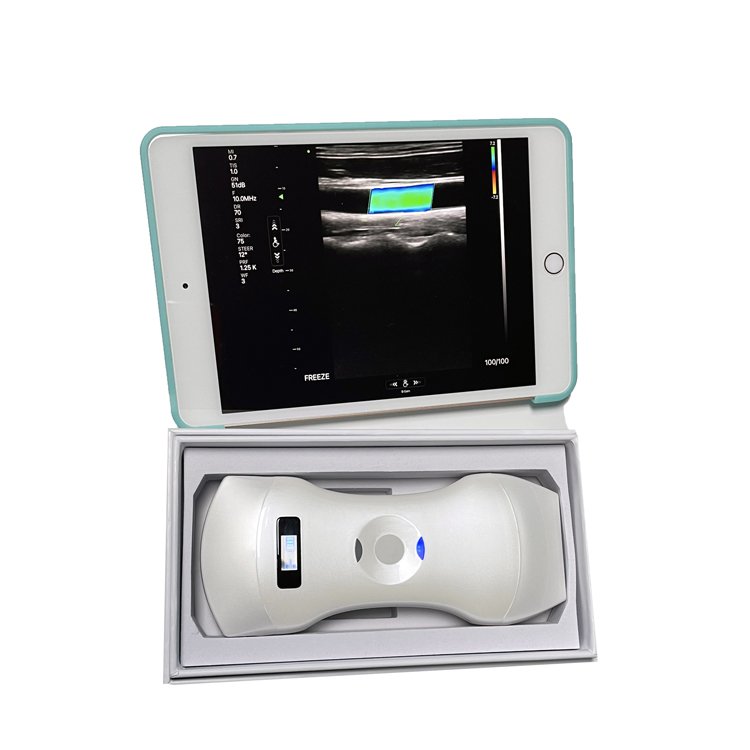 Medical Color Doppler Ultrasound Instruments 3 in 1 Wireless Phased Array Cardiac & Linear & Transvaginal/Endocavity & Convex