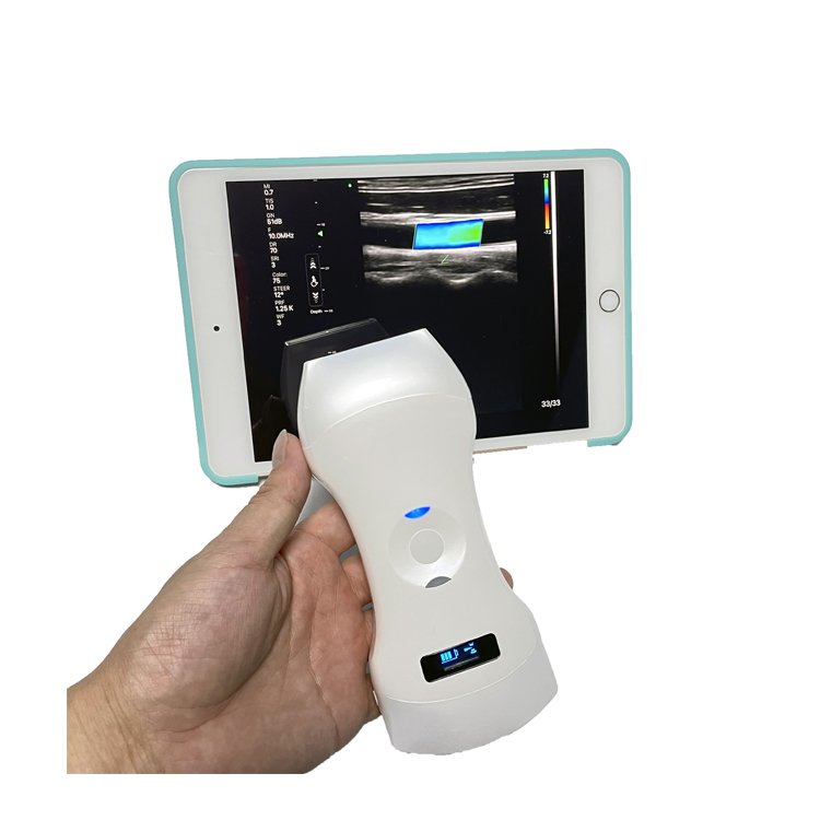 Medical Color Doppler Ultrasound Instruments 3 in 1 Wireless Phased Array Cardiac & Linear & Transvaginal/Endocavity & Convex