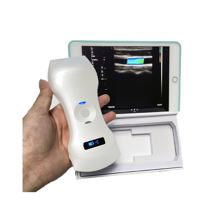 Medical Color Doppler Ultrasound Instruments 3 in 1 Wireless Phased Array Cardiac & Linear & Transvaginal/Endocavity & Convex