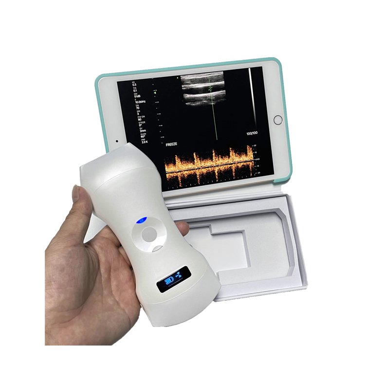 Medical Color Doppler Ultrasound Instruments 3 in 1 Wireless Phased Array Cardiac & Linear & Transvaginal/Endocavity & Convex