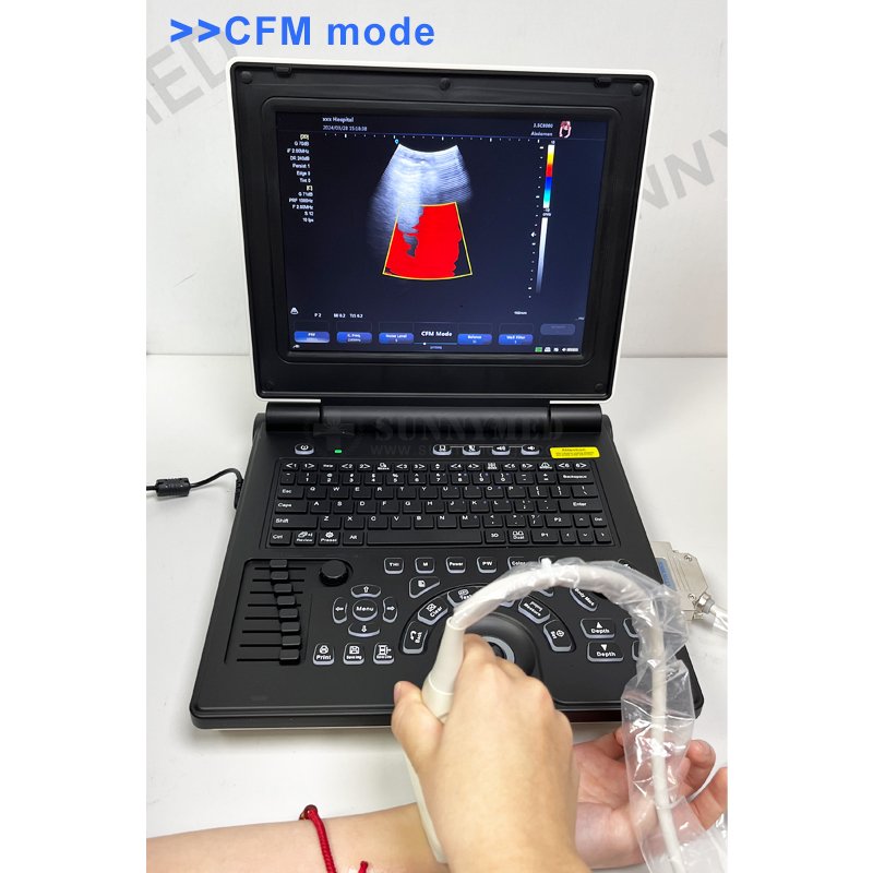 SY-A020E High Quality Color Doppler Laptop Ultrasound Diagnostic System 3d Ultrasound Scanner
