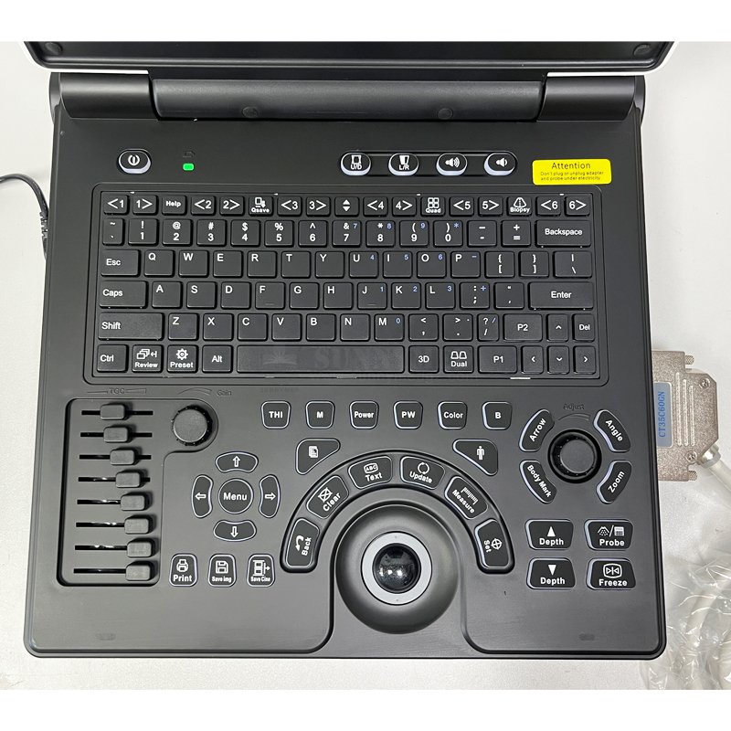 SY-A020E High Quality Color Doppler Laptop Ultrasound Diagnostic System 3d Ultrasound Scanner