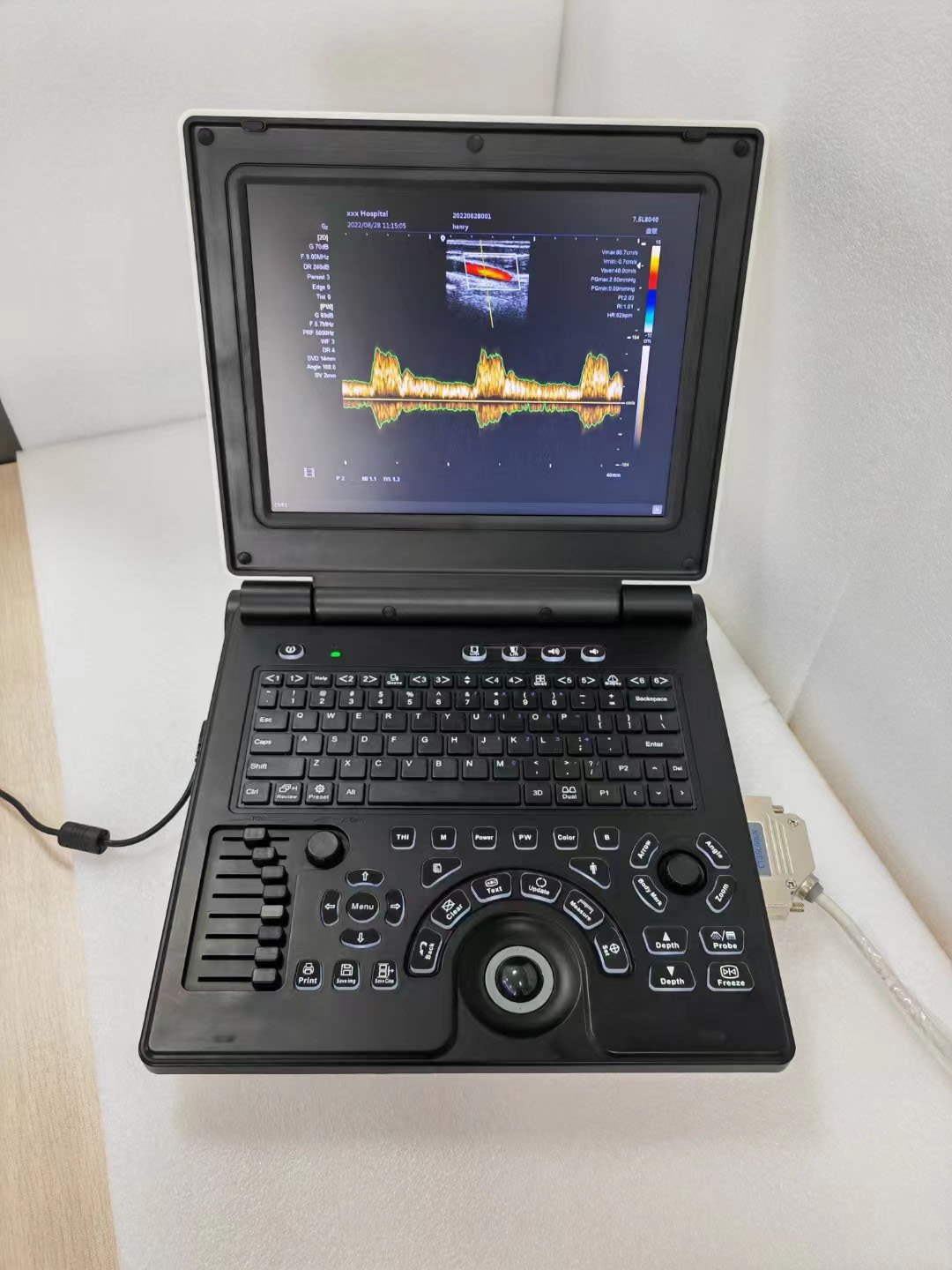 SY-A020E High Quality Color Doppler Laptop Ultrasound Diagnostic System 3d Ultrasound Scanner