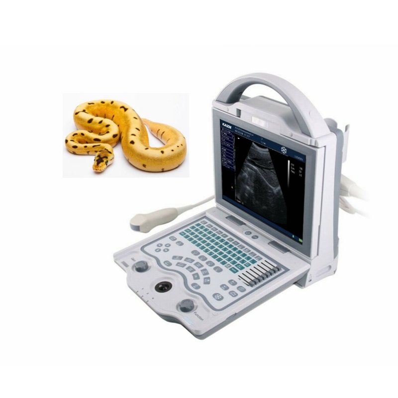 KX5600 Full Digital ultrasound machine portable for Human/Vet