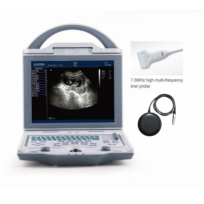 KX5600 Full Digital ultrasound machine portable for Human/Vet