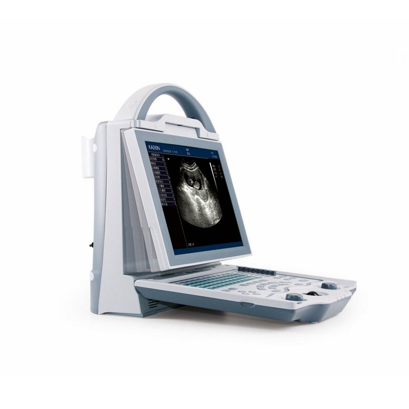 KX5600 Full Digital ultrasound machine portable for Human/Vet