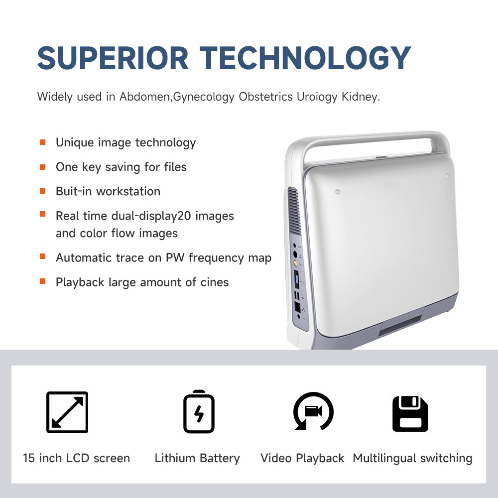 Doppler Hospital Digital Ultrasound Machine with Workstation Ultrasound Machine Portable Ultrasound Bone Densitometer