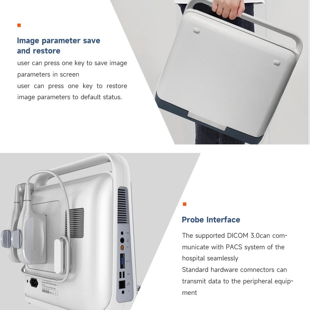 Doppler Hospital Digital Ultrasound Machine with Workstation Ultrasound Machine Portable Ultrasound Bone Densitometer