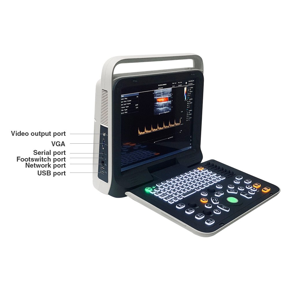 Doppler Hospital Digital Ultrasound Machine with Workstation Ultrasound Machine Portable Ultrasound Bone Densitometer