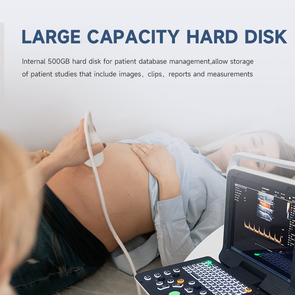 Doppler Hospital Digital Ultrasound Machine with Workstation Ultrasound Machine Portable Ultrasound Bone Densitometer