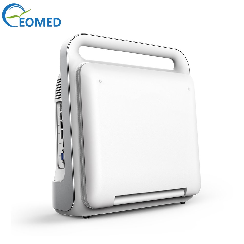 CU60B Echography Ultrasound Instruments Medical Ultrasound Scanner System Ultrasound Machine For Human Use