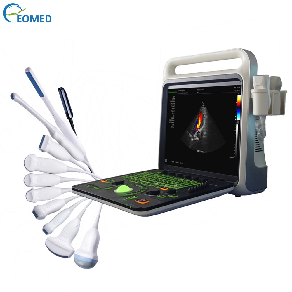 CU60B Echography Ultrasound Instruments Medical Ultrasound Scanner System Ultrasound Machine For Human Use