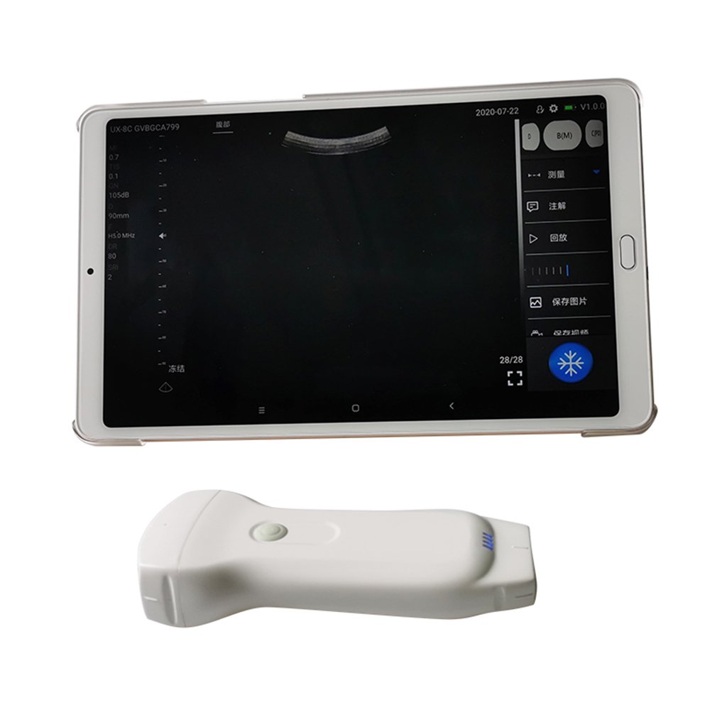Suresult Convex 128 Elements Wifi Linear Doppler Ultrasound Wireless Ultrasound For Ios Android Handheld Ultrasound