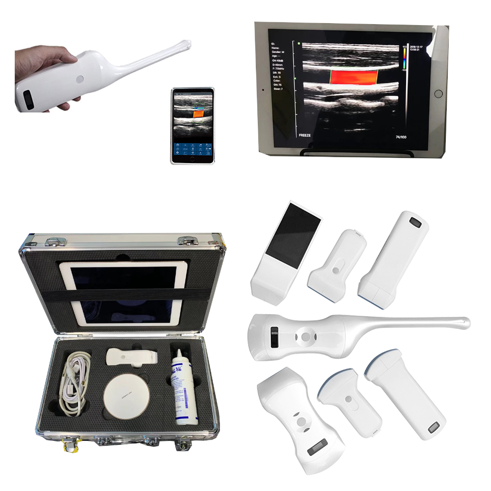 Suresult Convex 128 Elements Wifi Linear Doppler Ultrasound Wireless Ultrasound For Ios Android Handheld Ultrasound