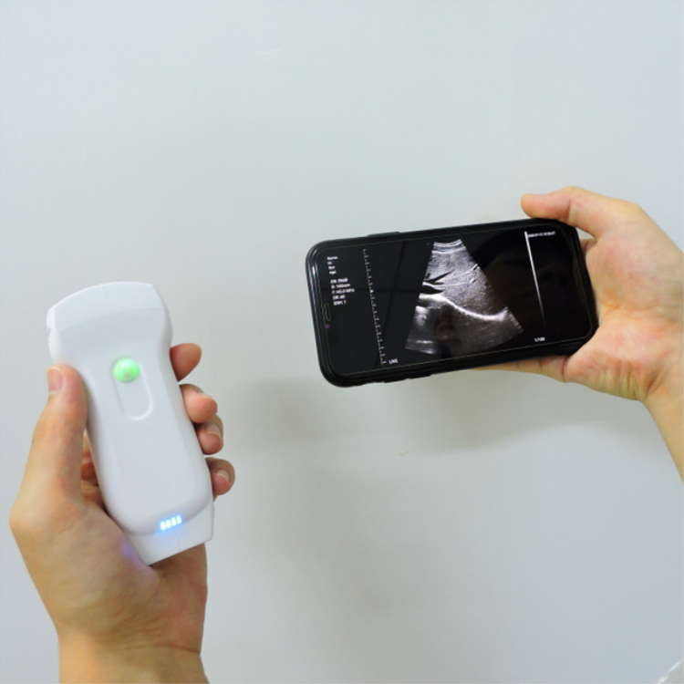 Suresult Convex 128 Elements Wifi Linear Doppler Ultrasound Wireless Ultrasound For Ios Android Handheld Ultrasound