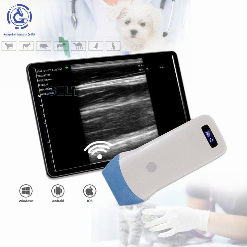 color Doppler wireless linear ultrasound 192 elements 10MHz-12MHz linear ultrasonic probe medical ultrasound instruments