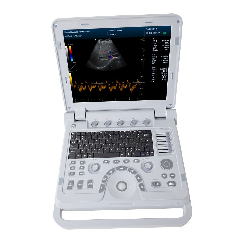 CONTEC CMS1700A cheap price medical ultrasound instruments cardiotocography china ultrasound machine