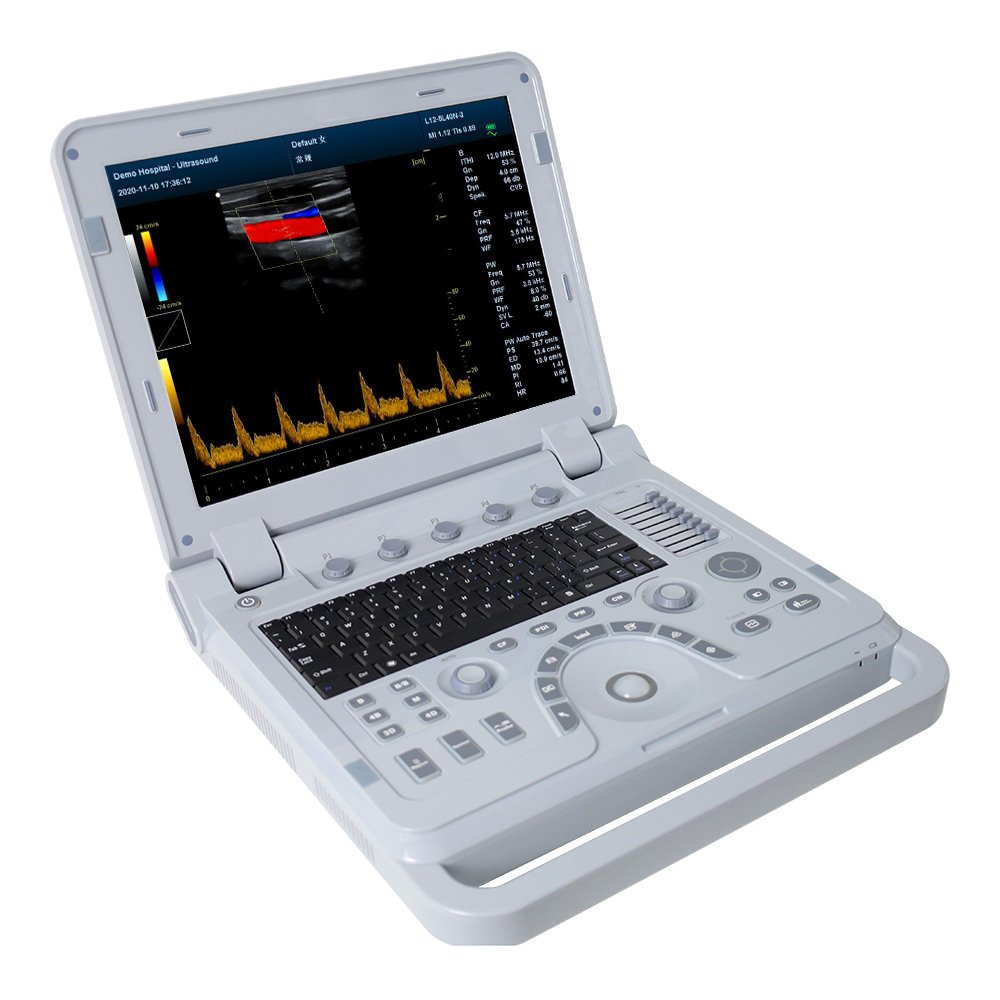 CONTEC CMS1700A cheap price medical ultrasound instruments cardiotocography china ultrasound machine