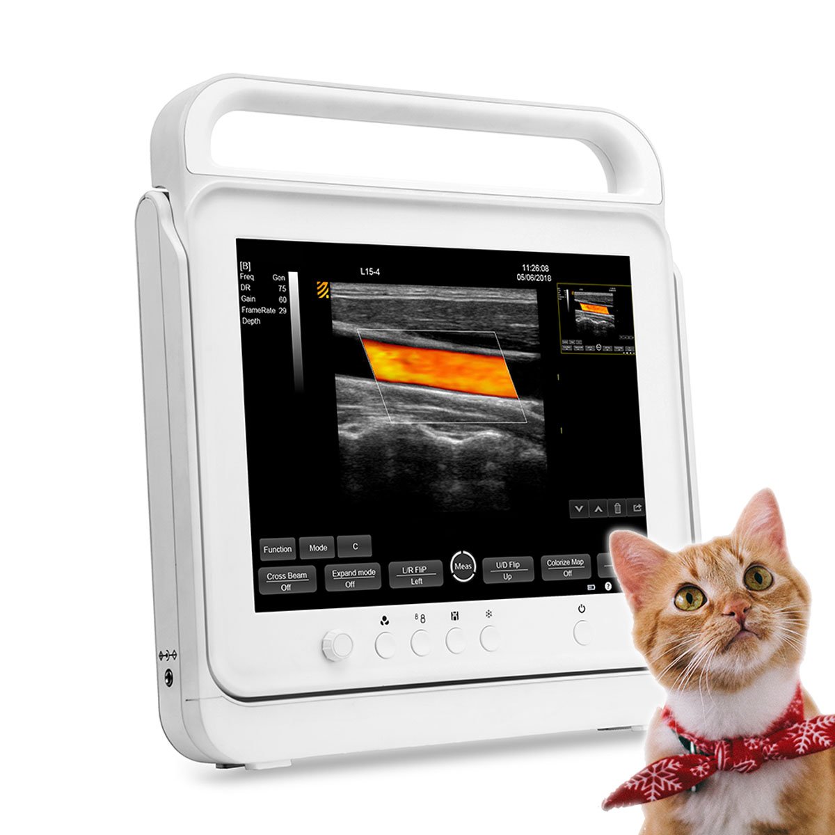 Portable Ultrasound Instrument Hand-Carried Color Doppler Ultrasound Machine Similar To Mindray Ultrasound
