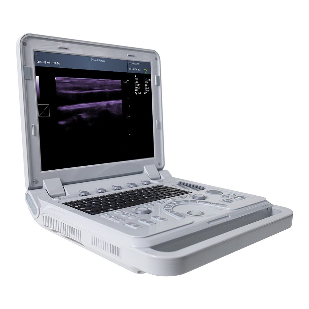 CONTEC CMS600P2 PLUS ultrasound pseudo color doppler ultrasound Pulse Spectral ultrasound